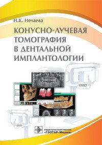Конусно-лучевая томография в дентальной имплантологии, Н. К. Нечаева