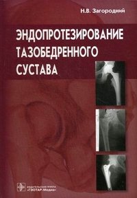 Эндопротезирование тазобедренного сустава. Основы и практика. Руководство. Загородний Н. В, Н. В. Загородний