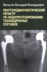 Рентгенологический регистр по эндопротезированию тазобедренных суставов, Геннадий Батыгин