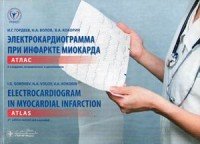 Электрокардиограмма при инфаркте миокарда. Атлас на русском и английском языках