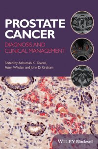 Prostate Cancer. Diagnosis and Clinical Management Peter  Whelan купить читать скачать онлайн - BookMix.ru