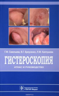 Гистероскопия. Атлас и руководство Г. М. Савельева, В. Г. Бреусенко, Л. М. Каппушева купить читать скачать онлайн - BookMix.ru