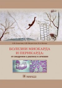 Болезни миокарда и перикарда. От синдромов к диагнозу и лечению, Ольга Владимировна Благова, Александр Викторович Недоступ, Елена Валерьевна Заклязьминская, Евгения