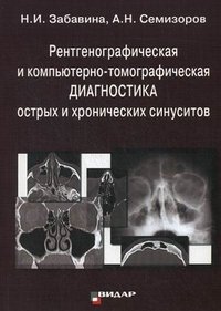Рентгенографическая и компьютерно-томографическая диагностика острых и хронических синуситов